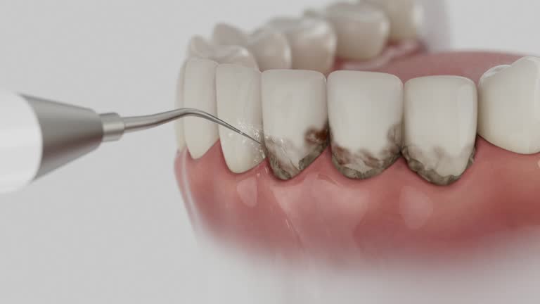 Reliable Dental Implants contractor in Iola, KS by Smile Center Dentistry